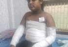రాగిజావపడి  విద్యార్థినికి తీవ్ర గాయాలు