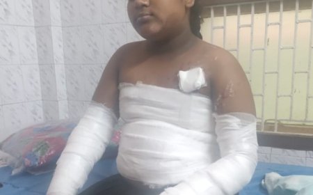 రాగిజావపడి  విద్యార్థినికి తీవ్ర గాయాలు