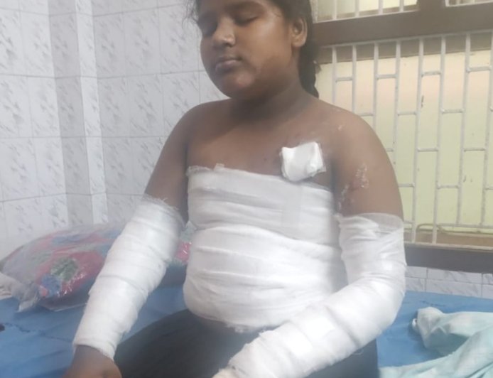 రాగిజావపడి  విద్యార్థినికి తీవ్ర గాయాలు
